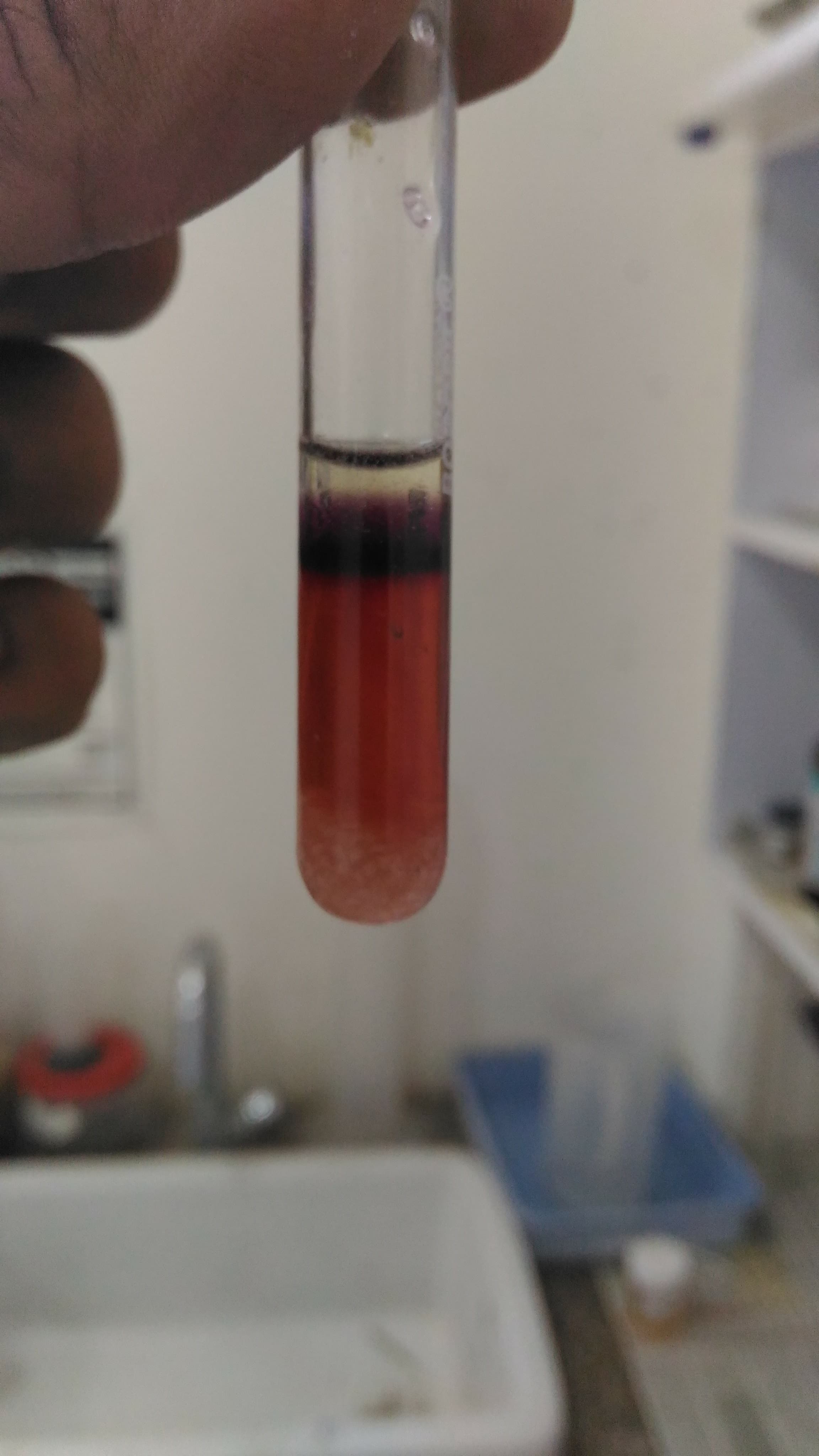 Blood Test Laboratory